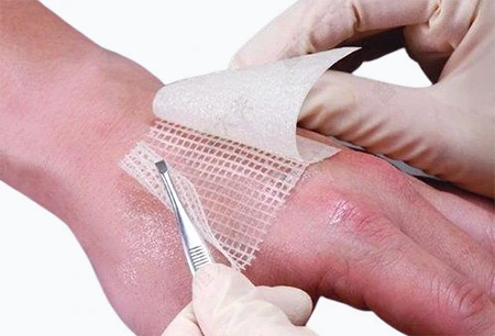 BIS CERTIFICATION OF MEDICATED PARAFFIN GAUGE DRESSING IS 16291:2014